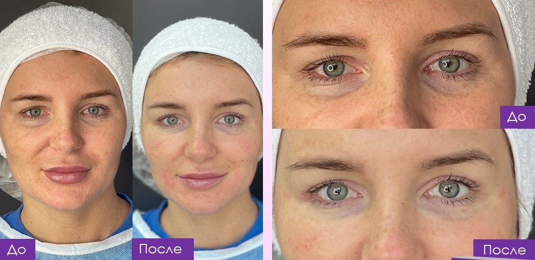 Клинический пример 1: динамика до и после