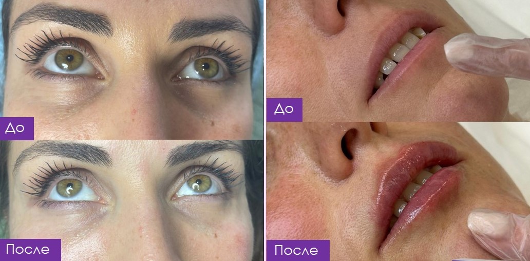 Клинический пример 3: динамика до и после